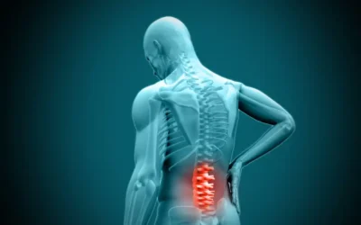 Mild Treatment for Spinal Stenosis