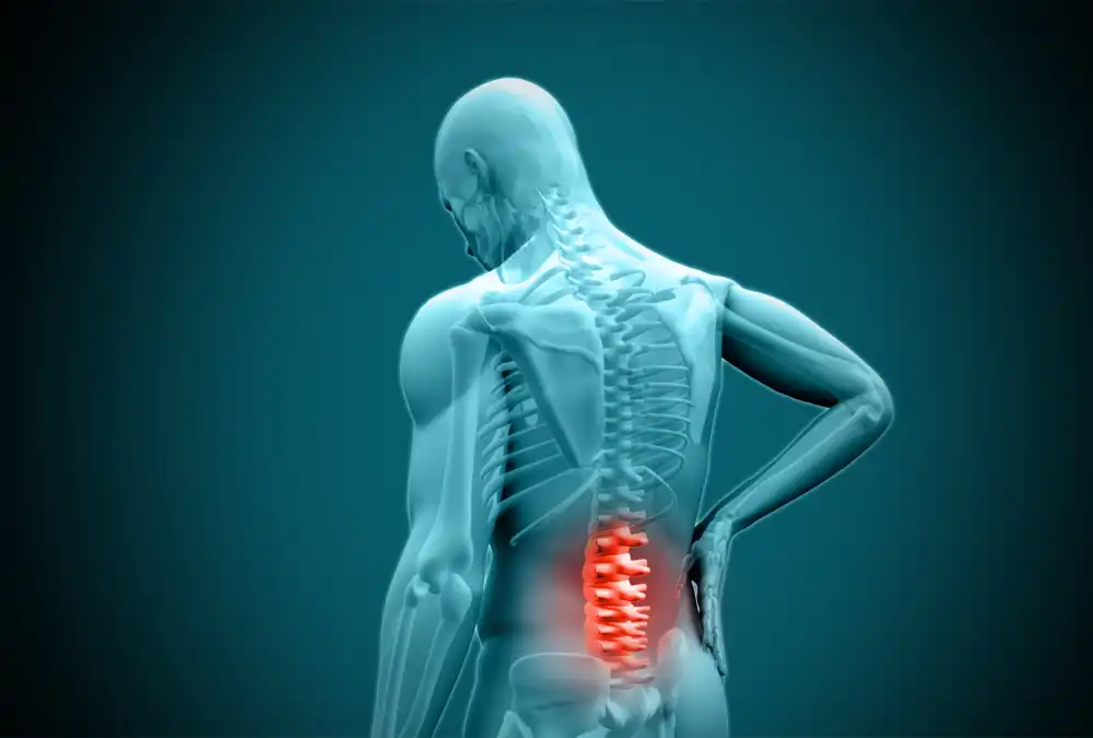 Mild Treatment for Spinal Stenosis